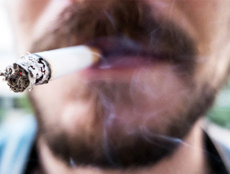 Já ouviu falar em Estomatite Nicotínica? Já ouviu falar em Estomatite Nicotínica?