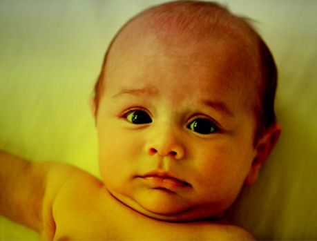 Entenda por que a Icterícia Neo-Natal ocorre Entenda por que a Icterícia Neo-Natal ocorre