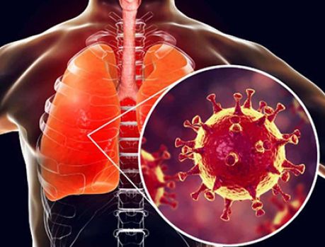 Coronavírus pode deixar sequelas no pulmão