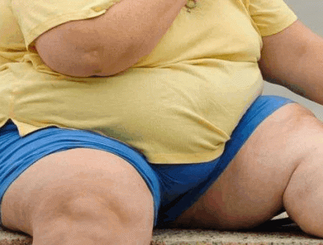 A OBESIDADE NO BRASIL É ALARMANTE! A OBESIDADE NO BRASIL É ALARMANTE!