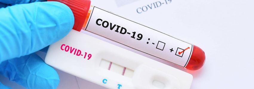 Mais 137 casos de Covid em Umuarama